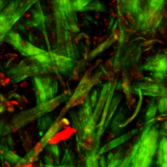 Le patrimoine culturel au microscope 